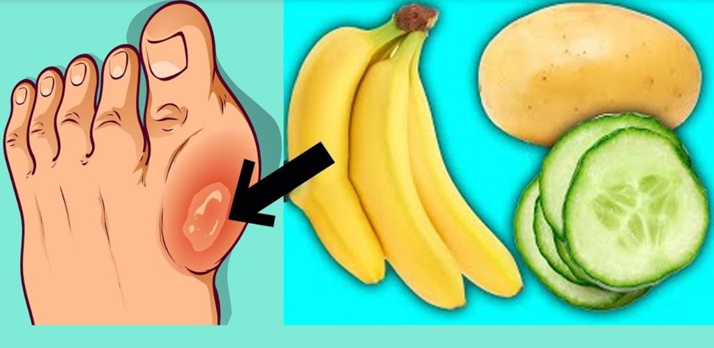 This is something everyone who has joint and bone pain should know!The best foods that will help you against joint and bone pain really effectively!