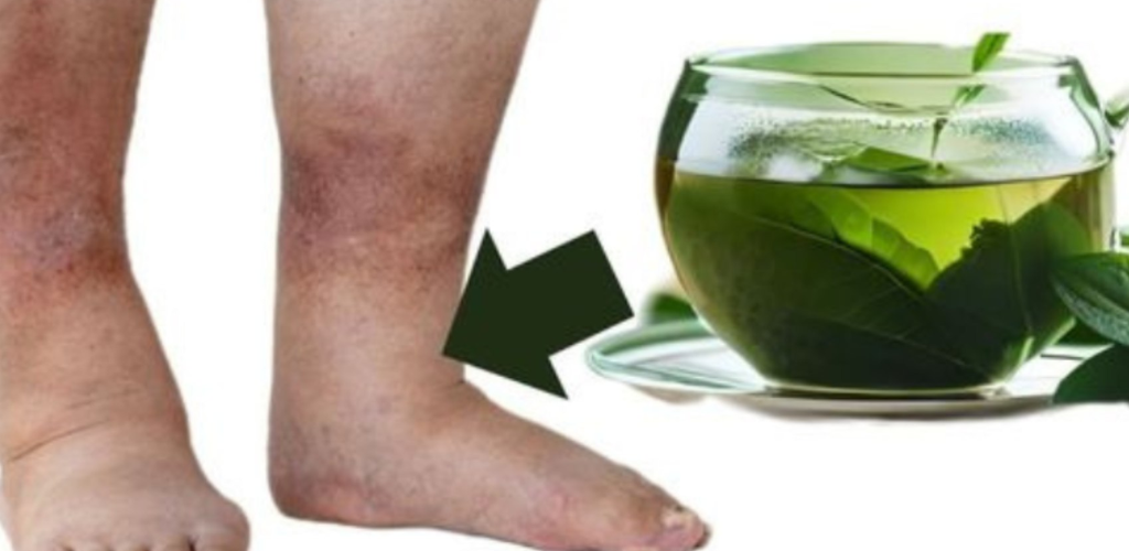 Sip Your Way to Relief: The Miracle Tea for Fast Puffiness Reduction