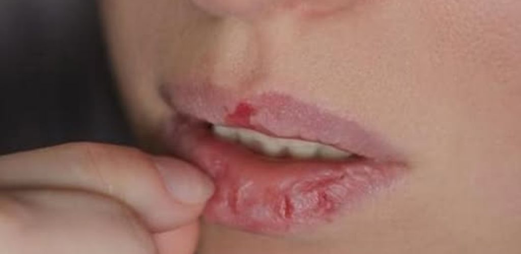7 Signs You Have Very Low Vitamin B6 Levels: You Won’t Believe It, Find Out How to Fix It