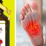 Discover the Benefits of Castor Oil for Health and Beauty»