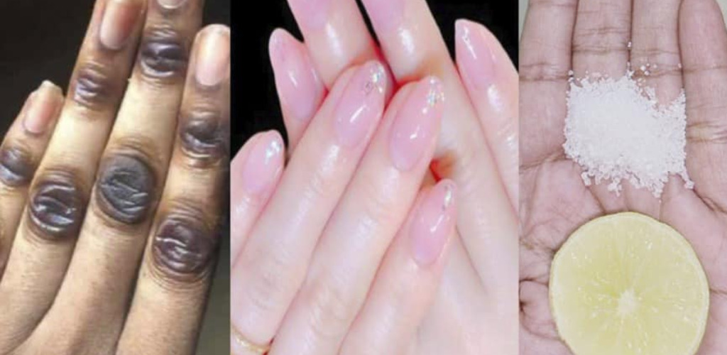 How to Rejuvenate Your Hands and Keep Them Soft and Young