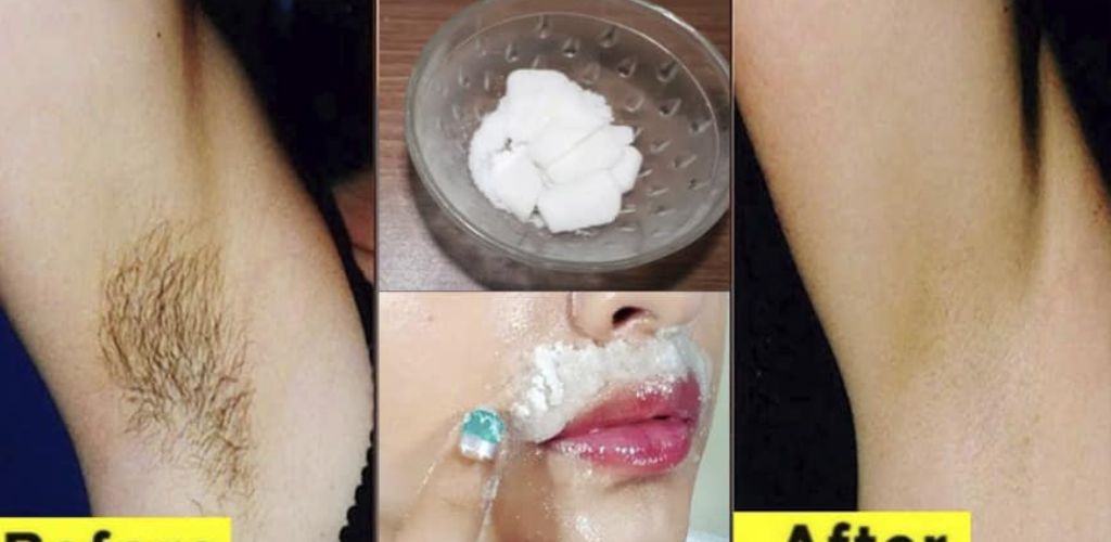 Natural hair removal with garlic: an effective alternative?