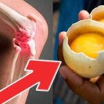 How to completely eliminate knee pain and “repair” joints with 2 eggs