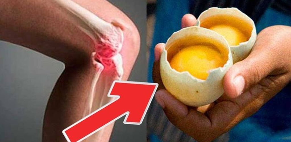How to completely eliminate knee pain and “repair” joints with 2 eggs