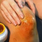 Mix honey and aspirin – a remedy that helps with pain in your knees and joints!