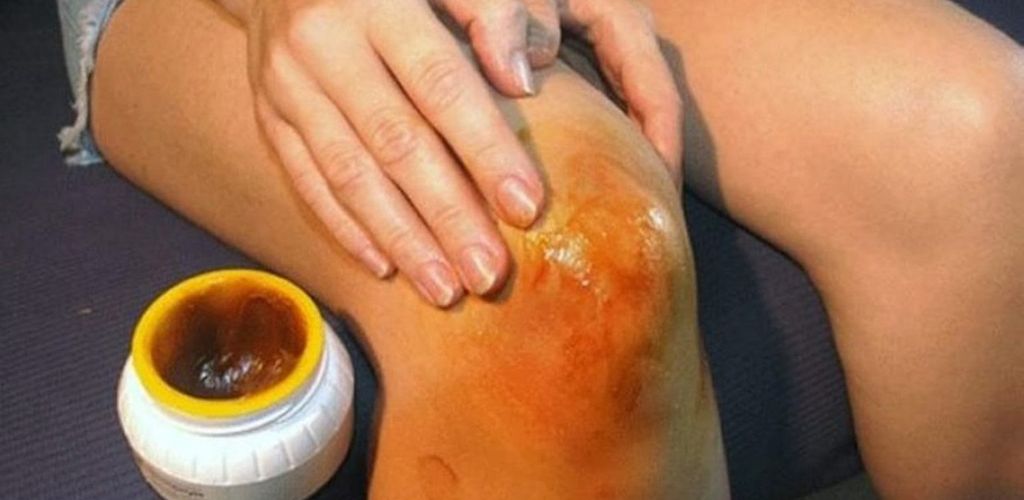 Mix honey and aspirin – a remedy that helps with pain in your knees and joints!