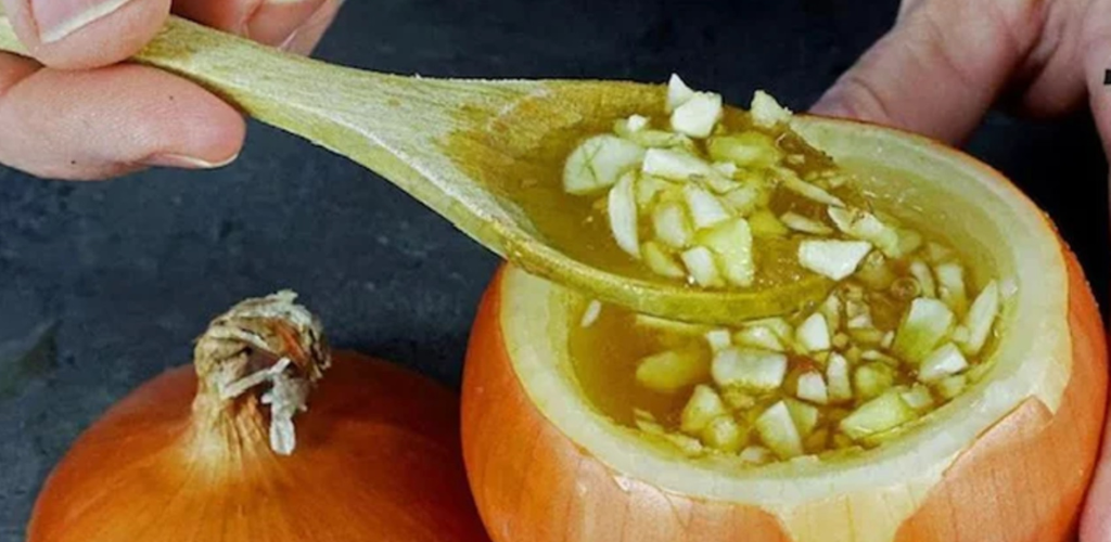 Honey and Onion Elixir – A Natural Antibiotic to Boost Your Immunity