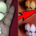 Did you know that garlic can whiten your teeth? Find out how to use it effectively