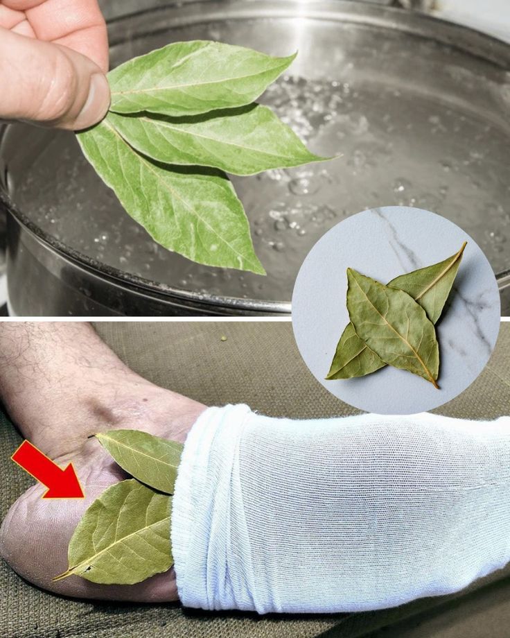 Apply Bay Leaves to Your Joints: Feel the Difference in Just a Weeks