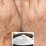 How to prepare an egg white mask to rejuvenate your hands by 15 years