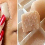 Grandma’s Tip for Dark Spots