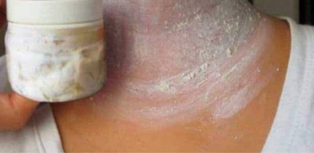 How to Eliminate Dark Areas on the Neck, Armpits and Thighs in Just 15 minutes?