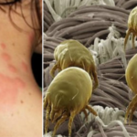 Don’t let the mites in your bed and clothes eat you alive! Spray this on them and you’ll never hear from them again.